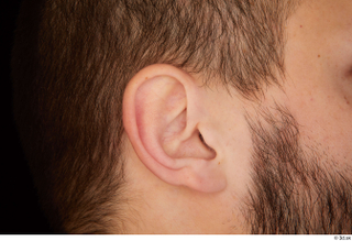 Orest ear 0001.jpg